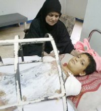 An injured Iraqi child - Al Jazeera