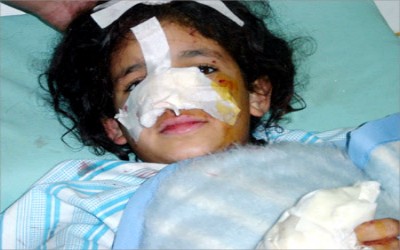 Injured girl in Baghdad - Al Jazeera TV