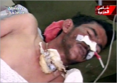 An injured Iraqi civilian - Al Jazeera