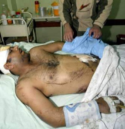 Another Iraqi civilian wounded in Basra